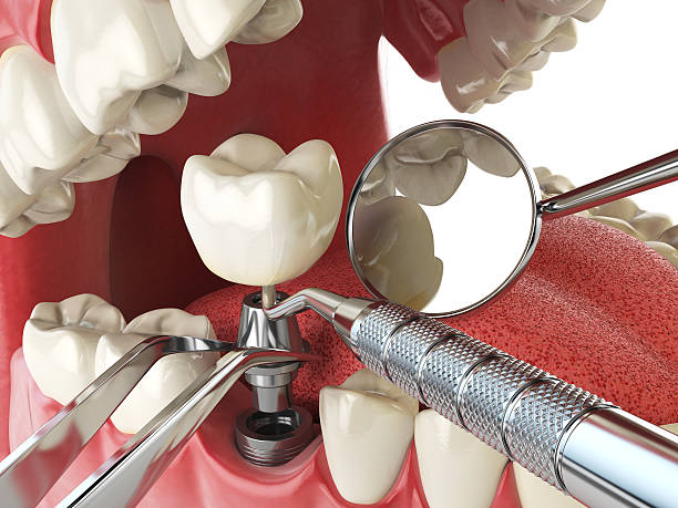 Best Emergency Treatment for Toothache in Averill Park, NY