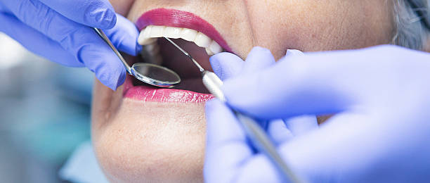 Best Emergency Broken Tooth Repair in Averill Park, NY